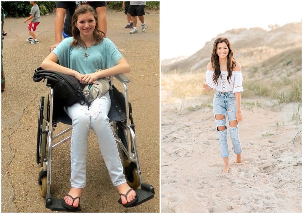 before and after chronic illness